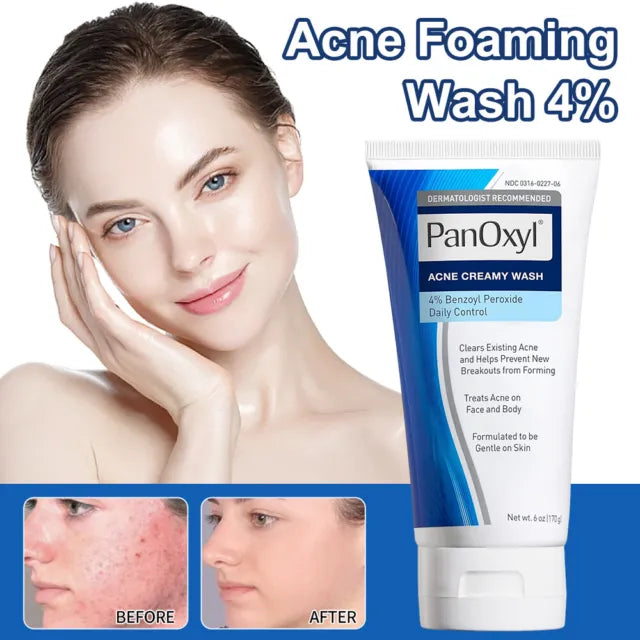 PanOxyl® Acne Creamy Wash Benzoyl Peroxide 4% – 156g